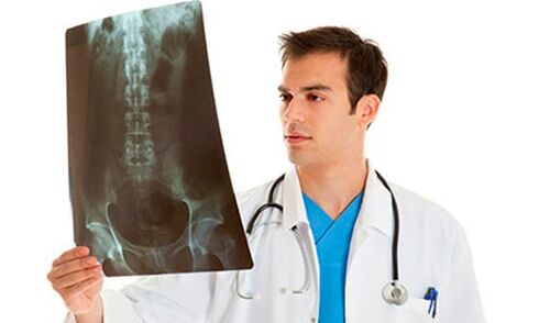 lekarz ogląda prześwietlenie, aby zdiagnozować ból krzyża