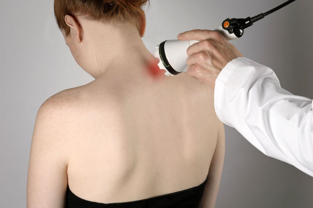 fizjoterapia leczenie osteochondrozy szyjnej