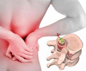 Lumbago na początku choroby osteoporozą